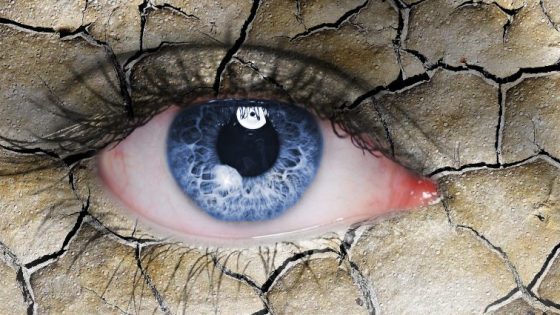 mata kering setelah lasik